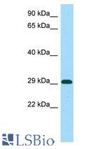 MICU1 / CBARA1 antibody Western Blot of MCF7. Antibody dilution: 1 ug/ml.