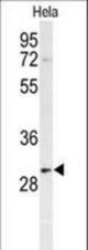 Western blot of PHB Antibody in HeLa cell line lysates (35 ug/lane). PHB (arrow) was detected using the purified antibody.