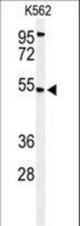 Western blot of CBAA1 Antibody in K562 cell line lysates (35 ug/lane). CBAA1 (arrow) was detected using the purified antibody.