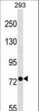 PHEX Antibody western blot of 293 cell line lysates (35 ug/lane). The PHEX antibody detected the PHEX protein (arrow).