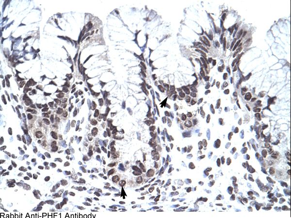 IHC of human stomach.