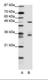 Western blot of 293T cell Lysate.
