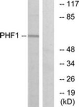 Western blot of extracts from HeLa cells, using PHF1 Antibody. The lane on the right is treated with the synthesized peptide.