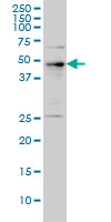 PHF1 monoclonal antibody (M01), clone 2D3 Western Blot analysis of PHF1 expression in A-431.