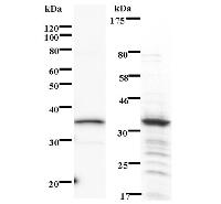 Left : Western blot analysis of immunized recombinant protein, using anti-PHF1 monoclonal antibody. Right : CBB staining of immunized recombinant protein.