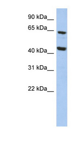 EFHA2 antibody LS-C111710 Western blot of HepG2 cell lysate.