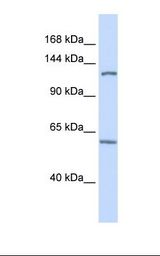 Fetal brain lysate. Antibody concentration: 1.0 ug/ml. Gel concentration: 6-18%.