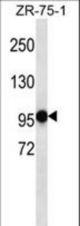 PHF14 Antibody western blot of ZR-75-1 cell line lysates (35 ug/lane). The PHF14 antibody detected the PHF14 protein (arrow).