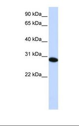 HepG2 cell lysate. Antibody concentration: 1.0 ug/ml. Gel concentration: 12%.