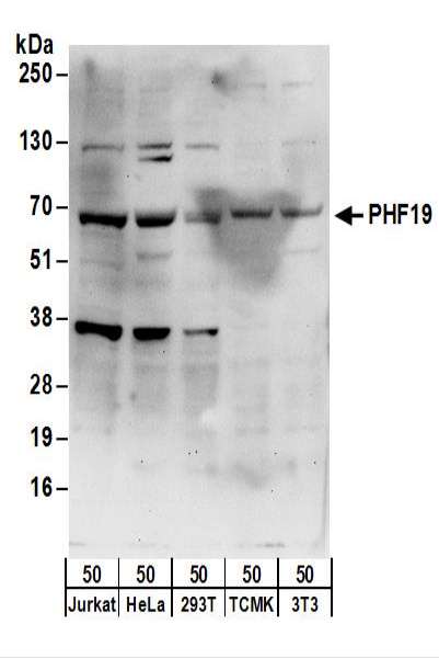 Detection of Human and Mouse PHF19 by Western Blot. Samples: Whole cell lysate (50 ug) from Jurkat, HeLa, 293T, mouse TCMK-1, and mouse NIH3T3 cells. Antibodies: Affinity purified rabbit anti-PHF19 antibody used for WB at 0.1 ug/ml. Detection: Chemiluminescence with an exposure time of 30 seconds.