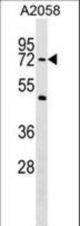 PHF19 Antibody western blot of A2058 cell line lysates (35 ug/lane). The PHF19 antibody detected the PHF19 protein (arrow).