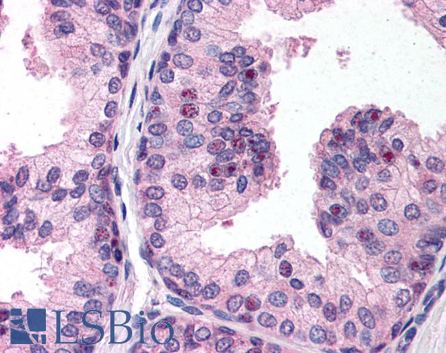 Anti-PHF2 antibody IHC of human prostate. Immunohistochemistry of formalin-fixed, paraffin-embedded tissue after heat-induced antigen retrieval. Antibody LS-B172 concentration 20 ug/ml.