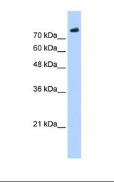 Jurkat cell lysate. Antibody concentration: 0.25 ug/ml. Gel concentration: 12%.