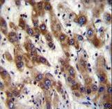 PHF20 Antibody immunohistochemistry of formalin-fixed and paraffin-embedded human liver tissue followed by peroxidase-conjugated secondary antibody and DAB staining.
