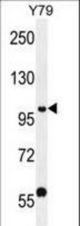 PHF20 Antibody western blot of Y79 cell line lysates (35 ug/lane). The PHF20 antibody detected the PHF20 protein (arrow).