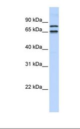 721_B ell lysate. Antibody concentration: 1.0 ug/ml. Gel concentration: 12%.