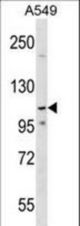 PHF20L1 Antibody western blot of A549 cell line lysates (35 ug/lane). The PHF20L1 antibody detected the PHF20L1 protein (arrow).