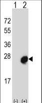 Western blot of MID1IP1 (arrow) using rabbit polyclonal MID1IP1 Antibody. 293 cell lysates (2 ug/lane) either nontransfected (Lane 1) or transiently transfected (Lane 2) with the MID1IP1 gene.