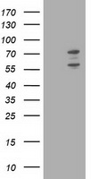 HEK293T cells were transfected with the pCMV6-ENTRY control (Left lane) or pCMV6-ENTRY PHF21B (Right lane) cDNA for 48 hrs and lysed. Equivalent amounts of cell lysates (5 ug per lane) were separated by SDS-PAGE and immunoblotted with anti-PHF21B.
