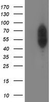 HEK293T cells were transfected with the pCMV6-ENTRY control (Left lane) or pCMV6-ENTRY PHF21B (Right lane) cDNA for 48 hrs and lysed. Equivalent amounts of cell lysates (5 ug per lane) were separated by SDS-PAGE and immunoblotted with anti-PHF21B.