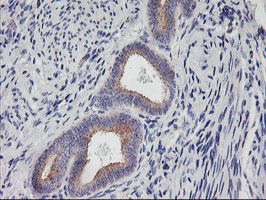 IHC of paraffin-embedded Human endometrium tissue using anti-PHF21B mouse monoclonal antibody.
