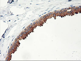 IHC of paraffin-embedded Human breast tissue using anti-PHF21B mouse monoclonal antibody.