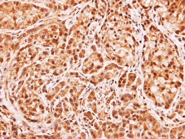 IHC of paraffin-embedded A549 xenograft using MID1IP1 antibody at 1:100 dilution.