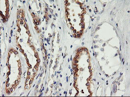 IHC of paraffin-embedded Human Kidney tissue using anti-PHF21B mouse monoclonal antibody.
