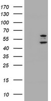 HEK293T cells were transfected with the pCMV6-ENTRY control (Left lane) or pCMV6-ENTRY PHF21B (Right lane) cDNA for 48 hrs and lysed. Equivalent amounts of cell lysates (5 ug per lane) were separated by SDS-PAGE and immunoblotted with anti-PHF21B.