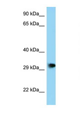 PHF23 antibody LS-C146207 Western blot of Mouse Brain lysate. Antibody concentration 1 ug/ml.