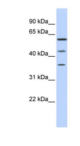 PHF23 antibody LS-C102382 Western blot of MCF7 cell lysate.