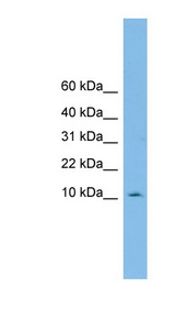 PHF5A antibody LS-C116341 Western blot of OVCAR-3 cell lysate.