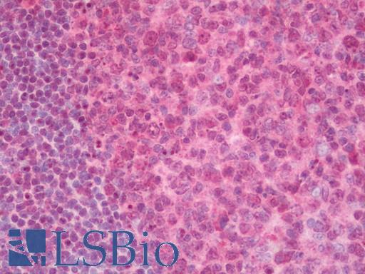 Human Tonsil: Formalin-Fixed, Paraffin-Embedded (FFPE) 