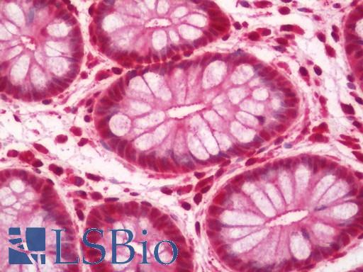 Human Colon: Formalin-Fixed, Paraffin-Embedded (FFPE)