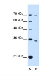 Lane A: Marker. Lane B: HepG2 cell lysate. Antibody concentration: 1.25 ug/ml. Gel concentration: 12%.