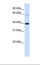 Fetal brain lysate. Antibody concentration: 1.0 ug/ml. Gel concentration: 12%.
