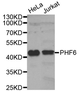Western blot analysis of extracts of various cell lines, using PHF6 antibody.