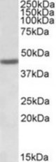 FANCL antibody (1 ug/ml) staining of Human Bone Marrow lysate (35 ug protein/ml in RIPA buffer). Primary incubation was 1 hour. Detected by chemiluminescence.