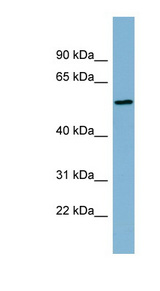 MIER2 antibody LS-C108081 Western blot of Fetal Stomach lysate.
