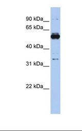 293T cell lysate. Antibody concentration: 1.0 ug/ml. Gel concentration: 12%.