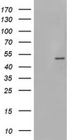 HEK293T cells were transfected with the pCMV6-ENTRY control (Left lane) or pCMV6-ENTRY PHKG2 (Right lane) cDNA for 48 hrs and lysed. Equivalent amounts of cell lysates (5 ug per lane) were separated by SDS-PAGE and immunoblotted with anti-PHKG2.