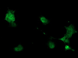 Anti-PHKG2 mouse monoclonal antibody immunofluorescent staining of COS7 cells transiently transfected by pCMV6-ENTRY PHKG2.