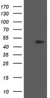 HEK293T cells were transfected with the pCMV6-ENTRY control (Left lane) or pCMV6-ENTRY PHKG2 (Right lane) cDNA for 48 hrs and lysed. Equivalent amounts of cell lysates (5 ug per lane) were separated by SDS-PAGE and immunoblotted with anti-PHKG2.