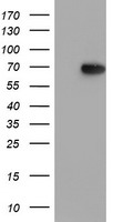 HEK293T cells were transfected with the pCMV6-ENTRY control (Left lane) or pCMV6-ENTRY MIER2 (Right lane) cDNA for 48 hrs and lysed. Equivalent amounts of cell lysates (5 ug per lane) were separated by SDS-PAGE and immunoblotted with anti-MIER2.