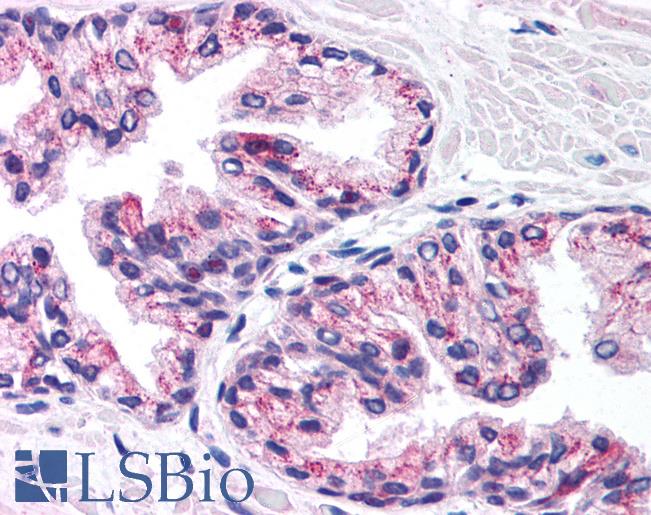 Anti-PHKG2 antibody IHC of human prostate. Immunohistochemistry of formalin-fixed, paraffin-embedded tissue after heat-induced antigen retrieval. Antibody LS-B993 concentration 5 ug/ml.