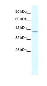 PHKG2 antibody LS-B993 Western blot of HepG2 cell lysate.