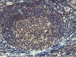 IHC of paraffin-embedded Human tonsil using anti-MIER2 mouse monoclonal antibody. (Heat-induced epitope retrieval by 10mM citric buffer, pH6.0, 100C for 10min).