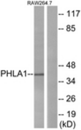 Western blot of extracts from RAW264.7 cells, using PHLA1 Antibody. The lane on the right is treated with the synthesized peptide.
