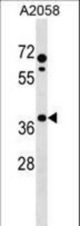 PHLDA1 Antibody western blot of A2058 cell line lysates (35 ug/lane). The PHLDA1 antibody detected the PHLDA1 protein (arrow).