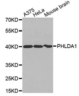Western blot analysis of extracts of various cell lines, using PHLDA1 antibody.